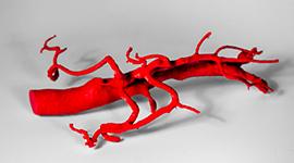 3D printed abdominal aorta